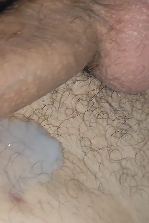 Removal of Phimosis to the White Juice of Hot Cum.