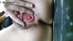 Video pregled