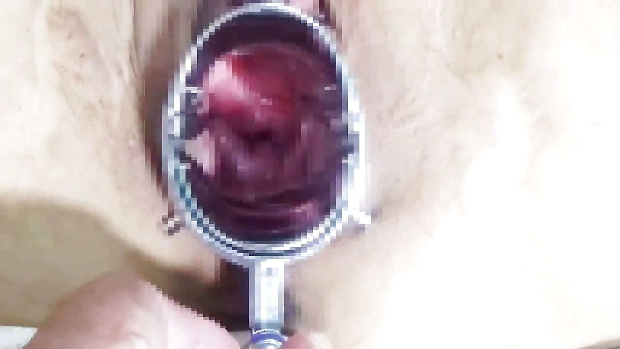 Using a Speculum to Spread an M-woman's Pussy, Anal Training12