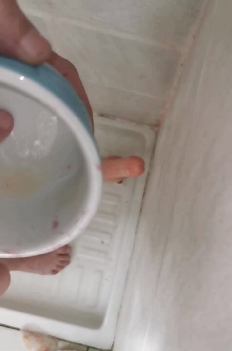 Morning prolapse