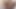 Subincision cock fqwfmasturbation