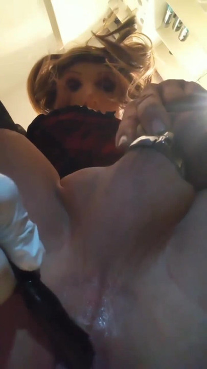 Analbaloon dwt anal