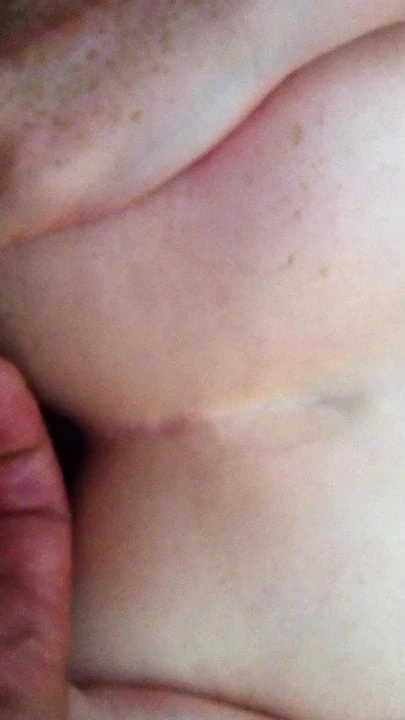 Anal Fail