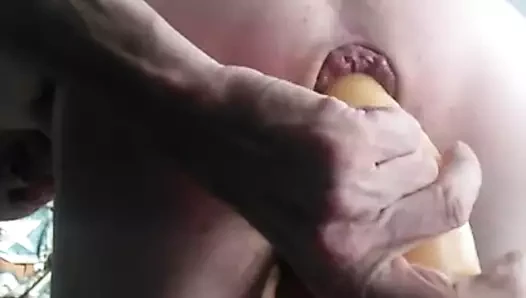 anal2