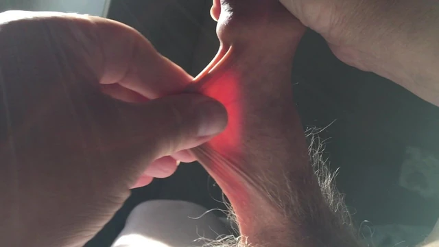 Sunshine foreskin five minute video - bat