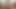 Lizzy Yum June 2023 just My Clit #2 Post Op orgasm pussy clit masturbation teasing orgasm