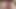 テス・ソロ