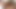 Skinny Slut Anal Gaped And Fisted