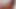 Private com - Doctor Vixi Rafi will cure you with a blowjob