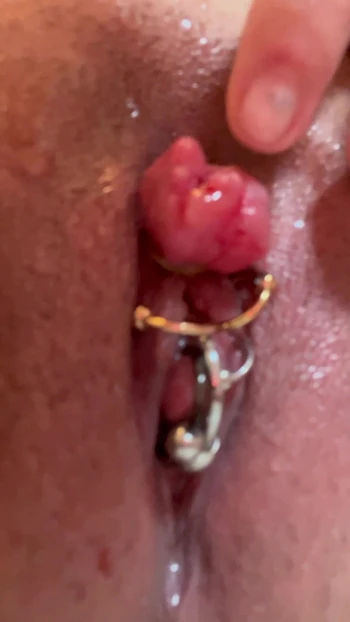 Enlarged clitoris bind