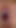 Barbie esm rahim ağzı muayenesinde anal bir fitil sokuyor