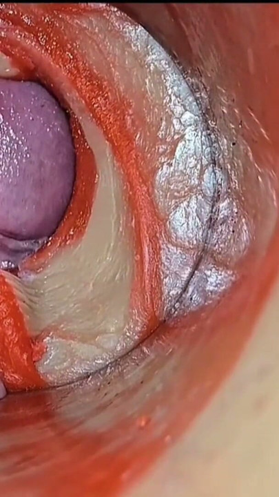 Cumfeti Dripping Creampie Compilation- Endoscopy view | Clip 1