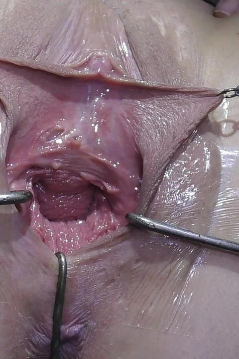 Wide Open