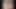 HD - Slowly Pulling Back My Foreskin (Smegma)
