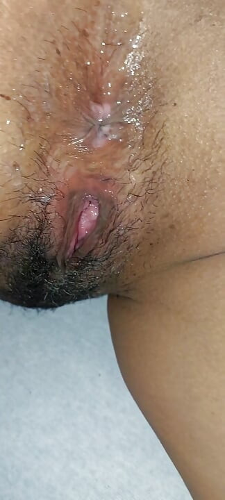 Vanessinha Called Me and When I Arrived She Was Like This with Her Back Like This