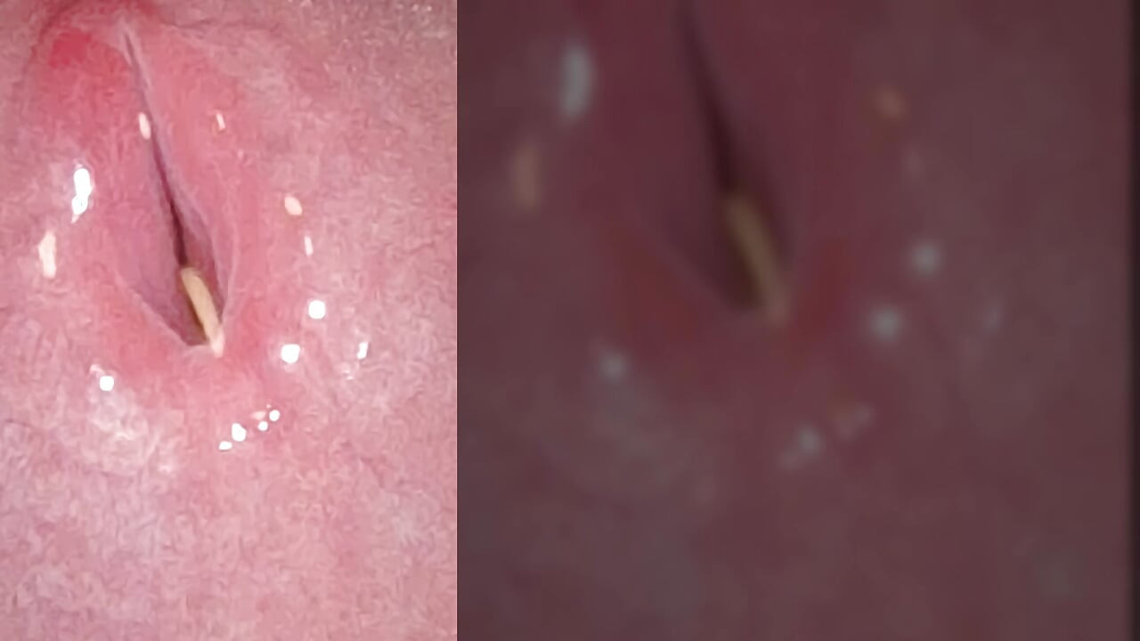 Playing With Zoom levels