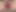 Anal boş çekebiliyor genişleyen anal