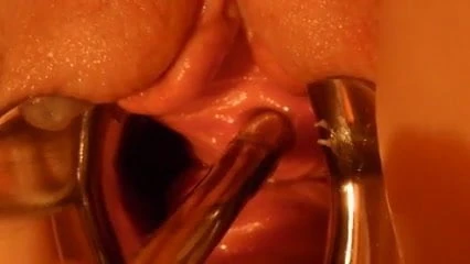 homemade catheter