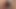 Metf 1 - Radia is in the bathroom so hot
