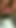 毛深い膣がおしっこをして誤っておならをしてしまう、非常にクローズアップの写真