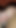 Full Open Video