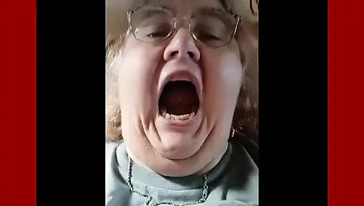 Requested Video Look Inside My Mouth