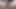変態角質アジア人みだら119