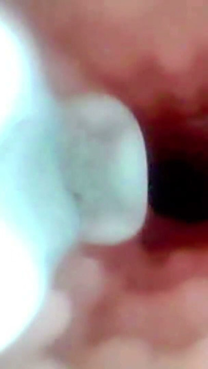 Un examen detallado de la cavidad oral y la zona anal de lopuza93 usando una cámara endoscópica | Clip 2