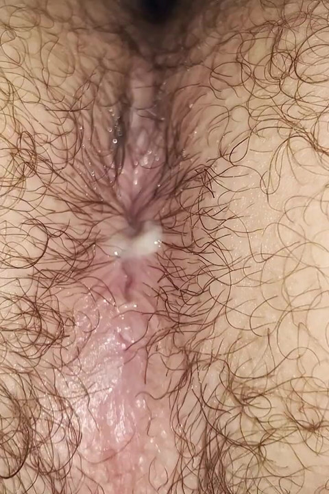 Closeup Assplay