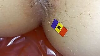 Chisinau Moldova hậu môn