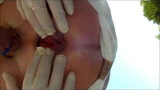 Mužský zadek prstění extrem