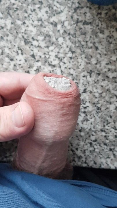 coffee under foreskin