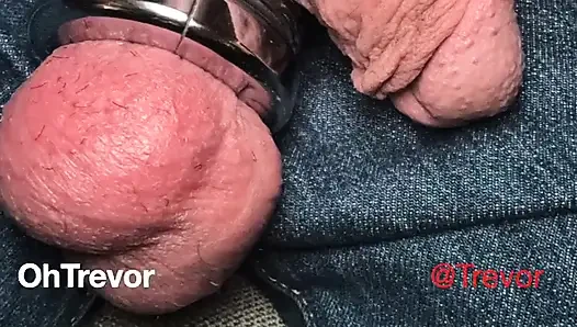 Ouch! Ball Weight Removal Gon Wrong