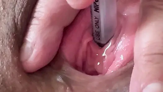 Peehole stretching