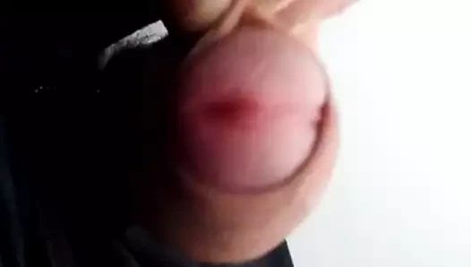 sünnet derisi okşayarak