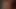 Mein verdammter arsch tut weh ... Das erwachen, beste zusammenstellung aus meinem gameplay