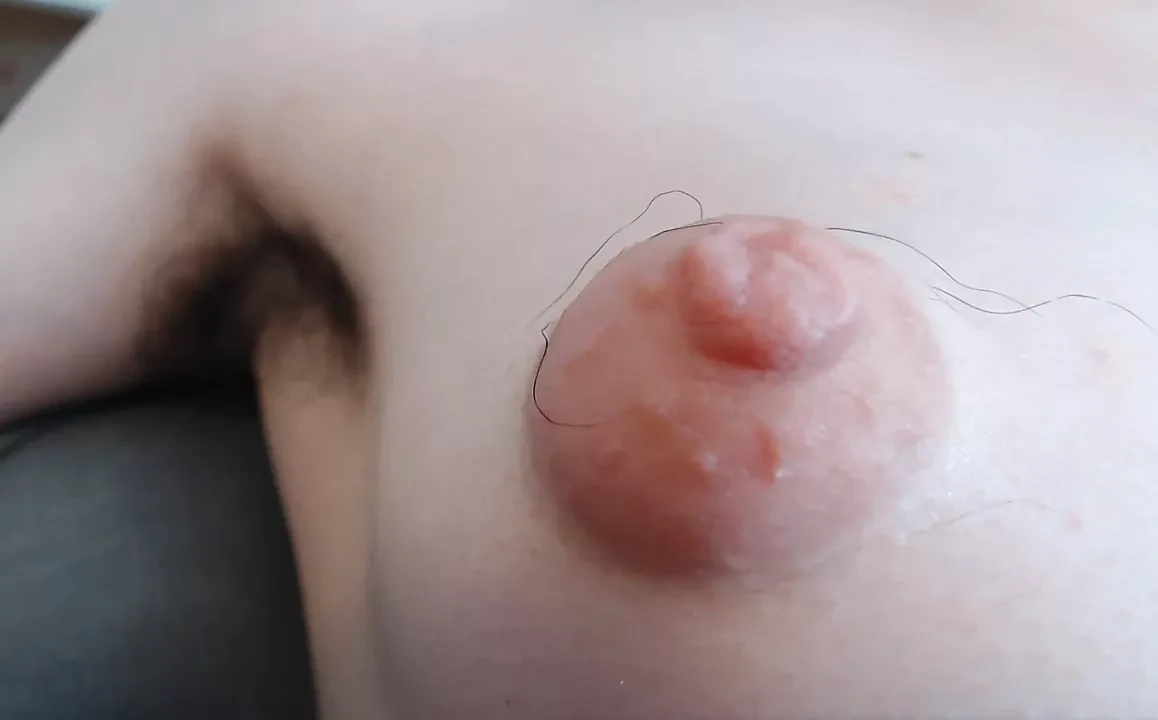 A hairy and Puffy Dream