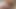 Infirmiere Salope Krankenschwester Blowjob Opuntia