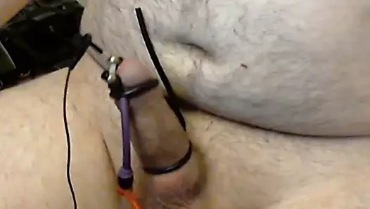 electro estim 060720150000101