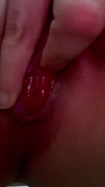 Spread anal