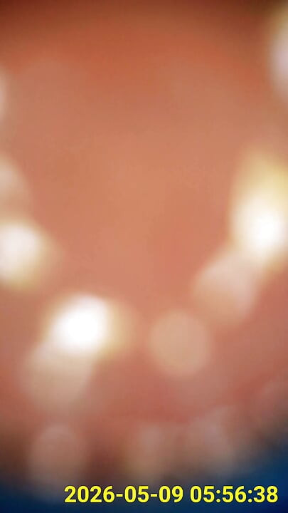 Close up of buttplug & HD Endoscope insertion