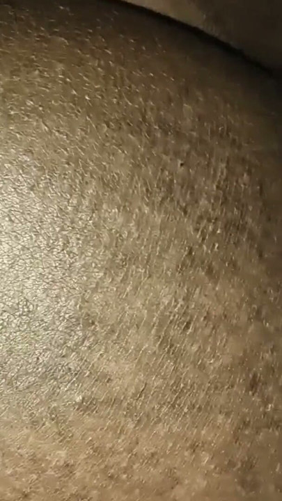foreskin play | Clip 1