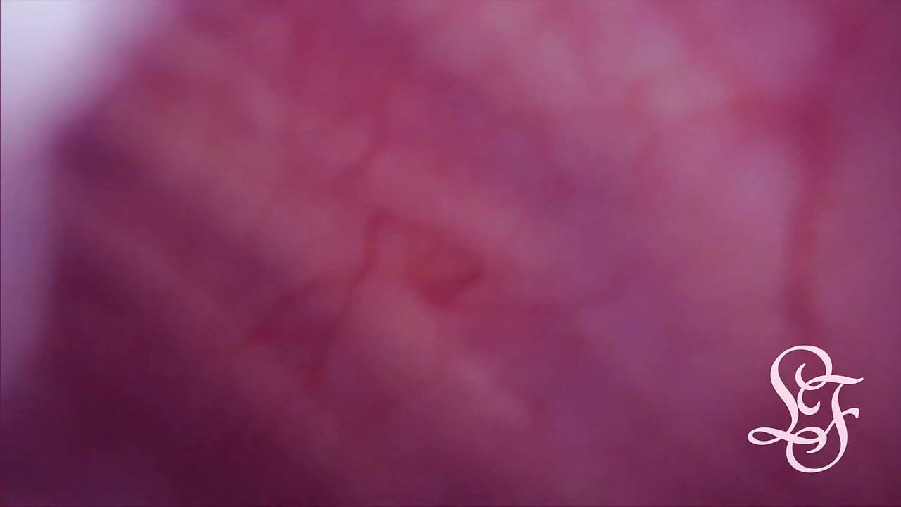 Bulge INSIDE my Bladder from Anal
