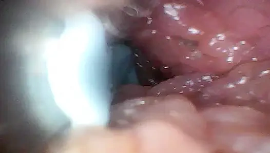 Экстремальная неуядность превращает наблюдателя в активного, голодного участника