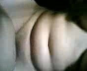 Bulu sikit