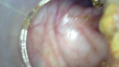 Deep deep anal again home colonoscopy Endoscope Part 1