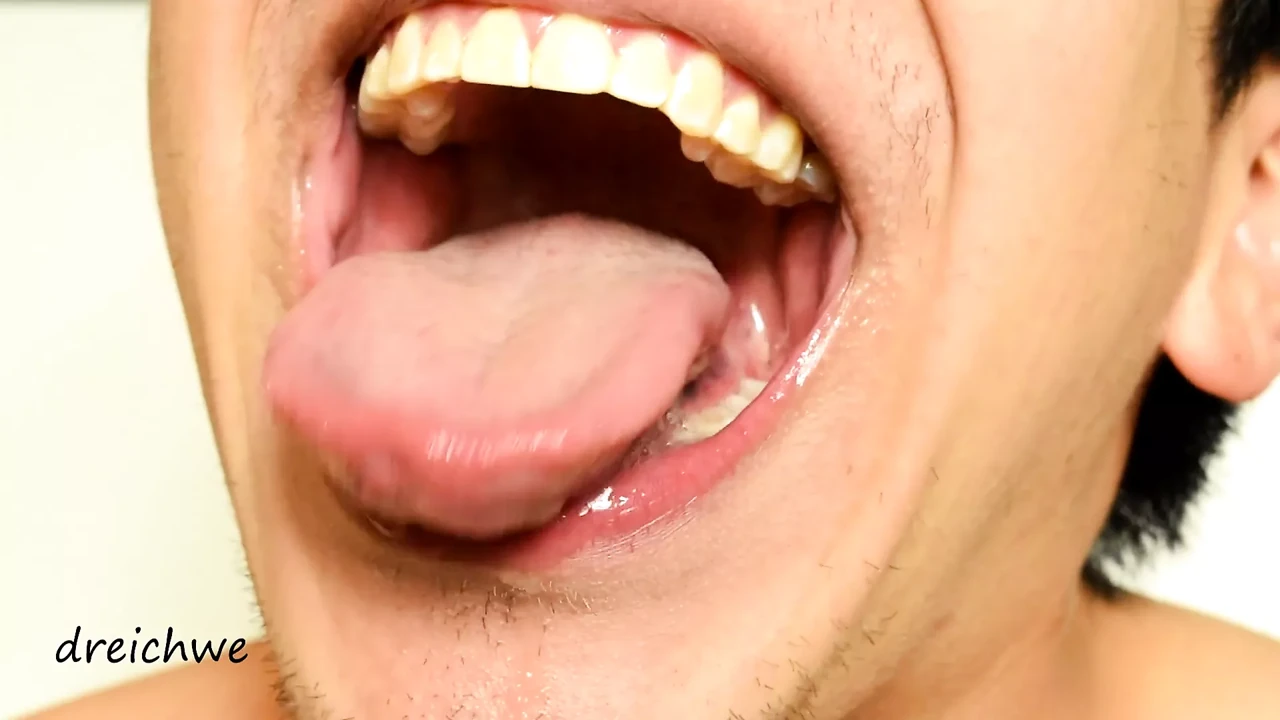 Drooling and showing uvula in HD drooling