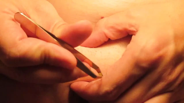 Old Clip from 2017: Hair Removal