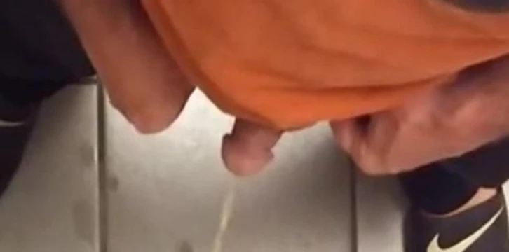Mushroom head circumcised