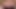 腹を叩かれ、顔や胸を叩く